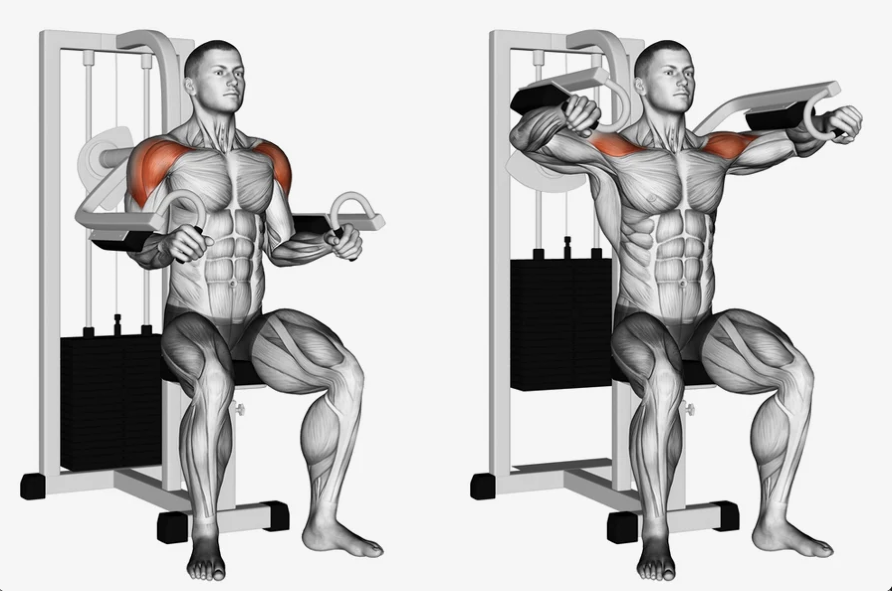 Lateral Raise Machine: A Hidden Gem or Overlooked Equipment?